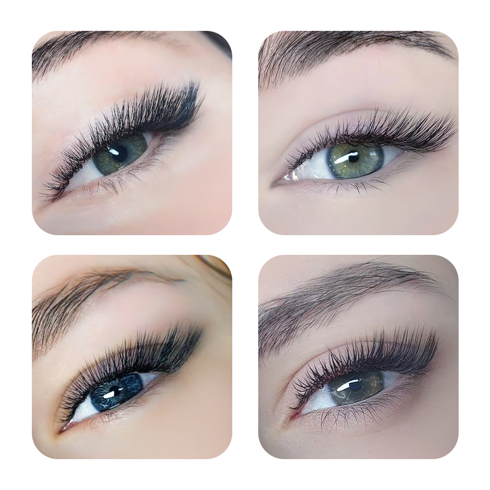 view
